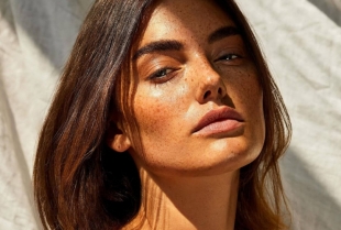 Skin Facts: Da li su pege zapravo oštećenja od sunca?
